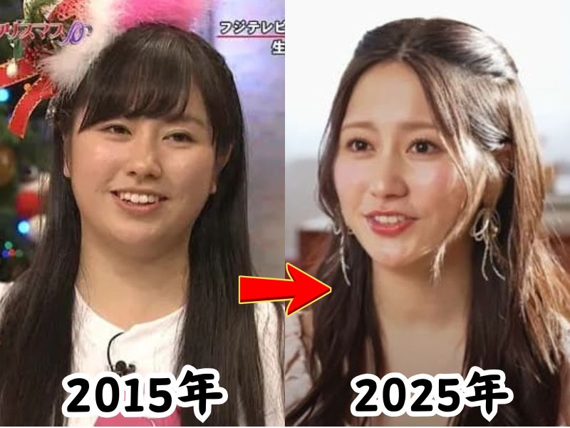 顔が変わったと話題になったももクロのあーりんこと佐々木彩夏さんの2015年の姿と2025年の姿を比較した画像