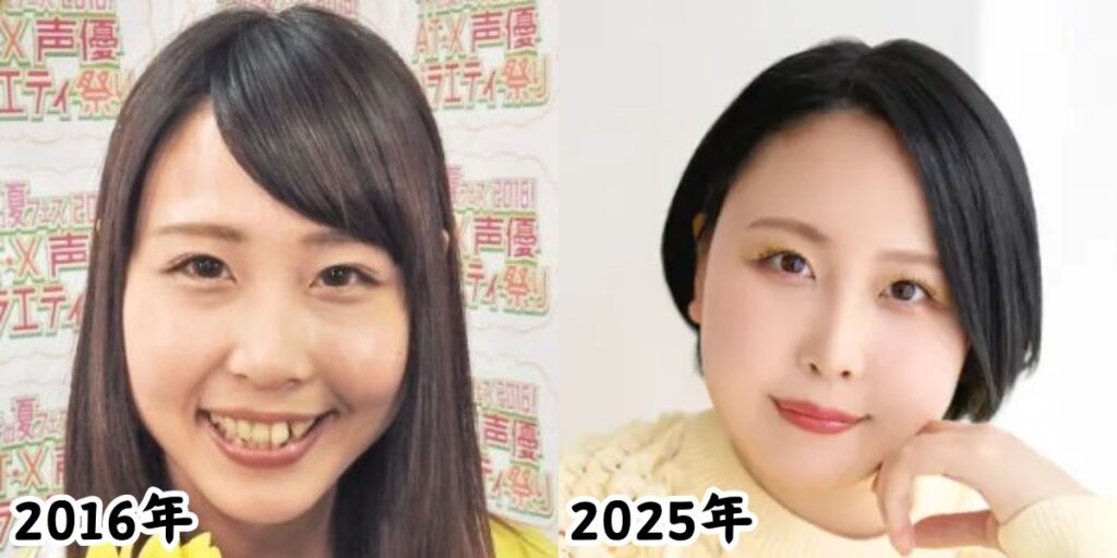木村千咲さんの痩せていた2016年の姿と太ったと話題になった2025年の姿を比較した画像