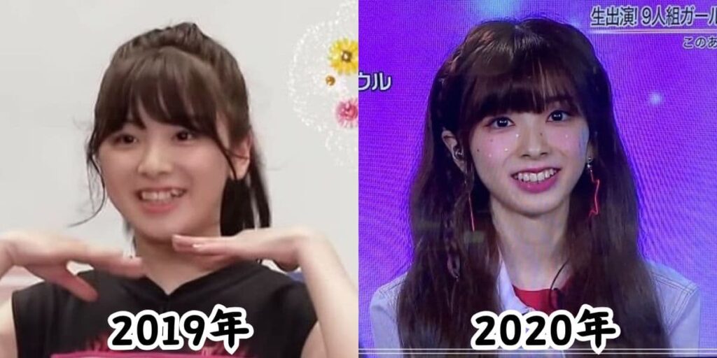 NiziUミイヒの2019年オーディション時のふっくらしていた姿と2020年のデビュー時激やせしたと話題になった姿を比較した画像