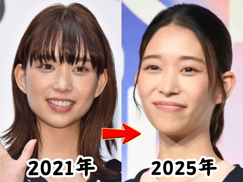 エラがシャープになり整形疑惑が浮上した森川葵さんの2021年と2025年の姿を比較した画像