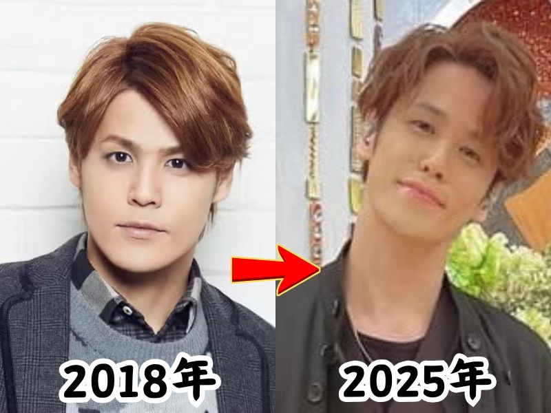 宮野真守さんのふっくらしていた2018年の姿と瘠せたと話題になった2025年の姿を比較した画像