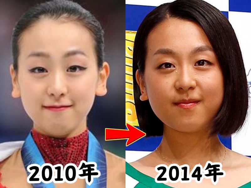 浅田真央のスリム体型だった2010年の姿と太ったと話題になった2014年の姿を比較した画像