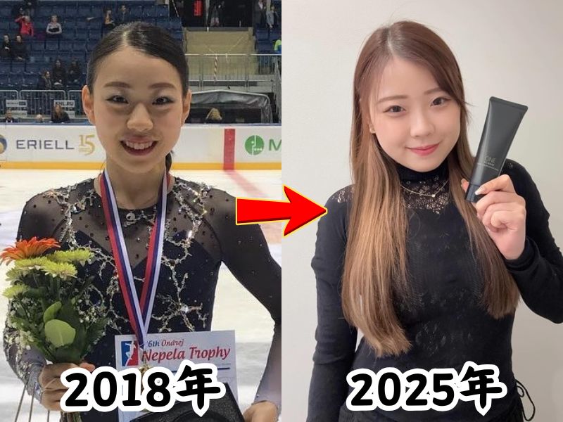 紀平梨花さんの痩せていた2018年の姿と太ったと話題になった2025年の姿を比較した画像