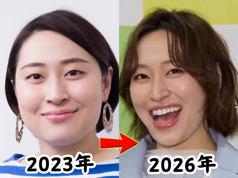 痩せた姿が話題となった丸山礼さんの2023年当時と2026年最新の姿を比較したビフォーアフター画像
