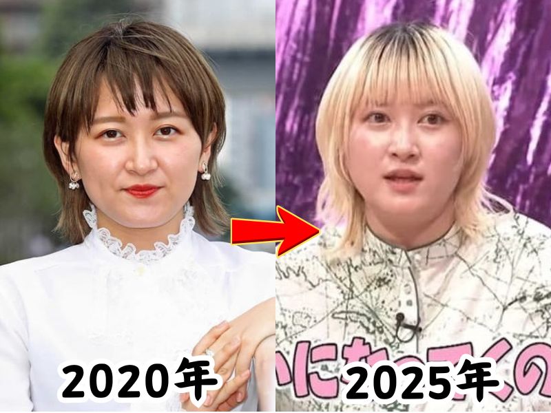 ラランド・サーヤの痩せていた2020年の姿と太ったと話題になった2025年の姿を比較した画像