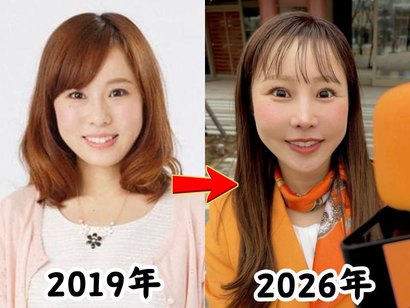 顔が変わったと話題の馬場ももこアナの2019年当時の姿と2026年最新の姿を比較した画像