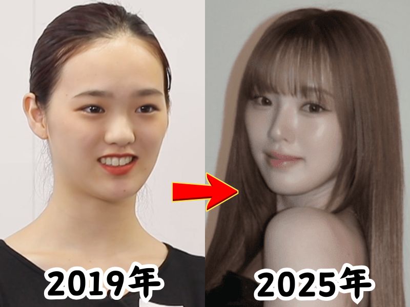 顔が変わったと話題になったNiziuリオさんの虹プロ時代2019年当時の姿と2025年当時の姿を比較した画像