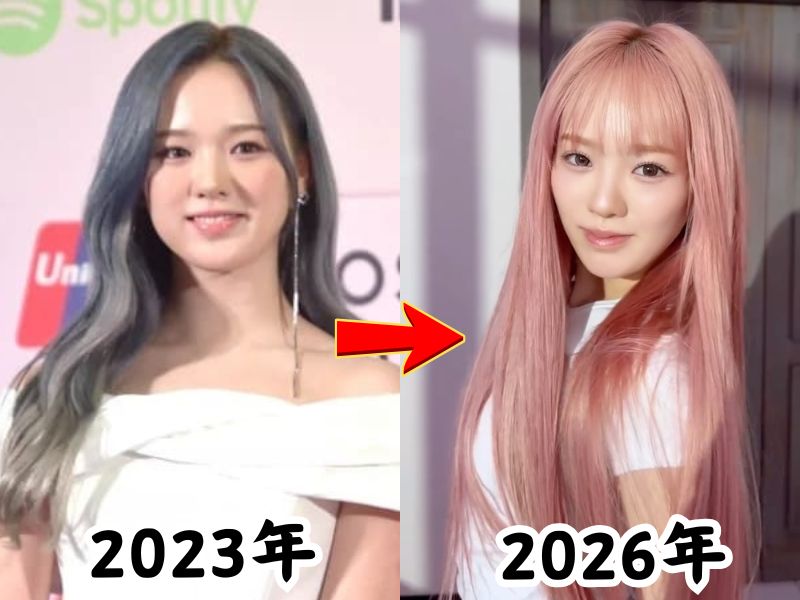 顔が変わったと話題になったNiziuリオさんの2023年当時の姿と2026年最新の姿を比較した画像
