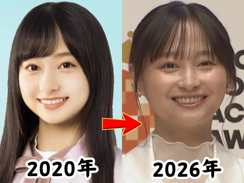 影山優佳さんの2020年当時の姿と太ったと話題になった2026年最新の姿を比較した画像