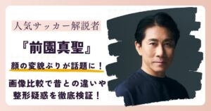 【2026最新】前園真聖の顔が変わった？画像比較で整形疑惑や昔との違いを徹底検証！