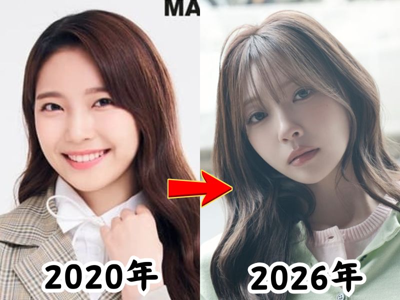 顔が変わったと話題になったNiziUマユカさんの2020年当時と2026年現在の姿を比較した画像