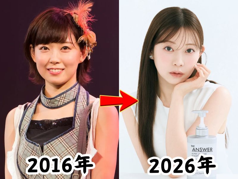 顔が変わったと話題になった元NMB48の渡辺美優紀の2016年当時と2026年最新の姿を比較した画像
