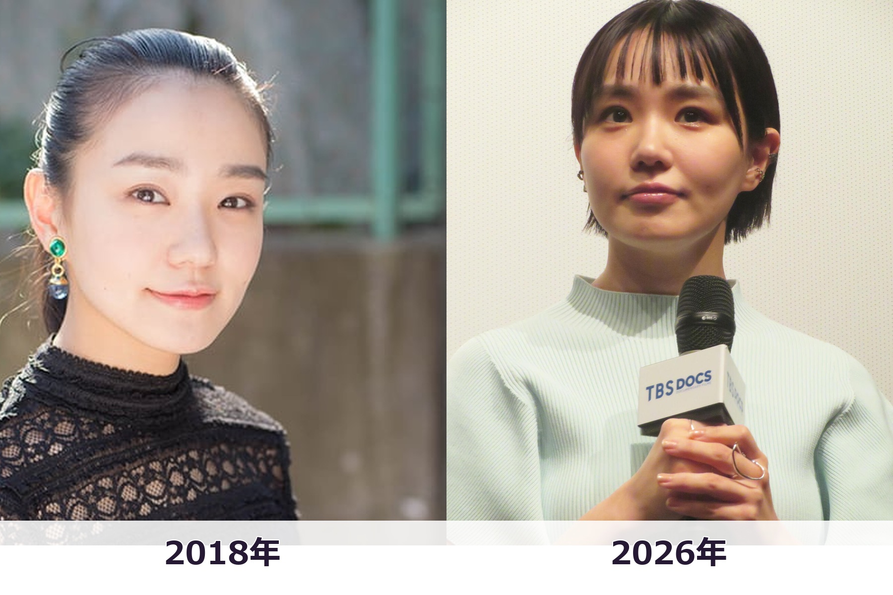 顔が変わったと話題になった奈緒さんの2018年当時と2026年現在の姿を比較した画像