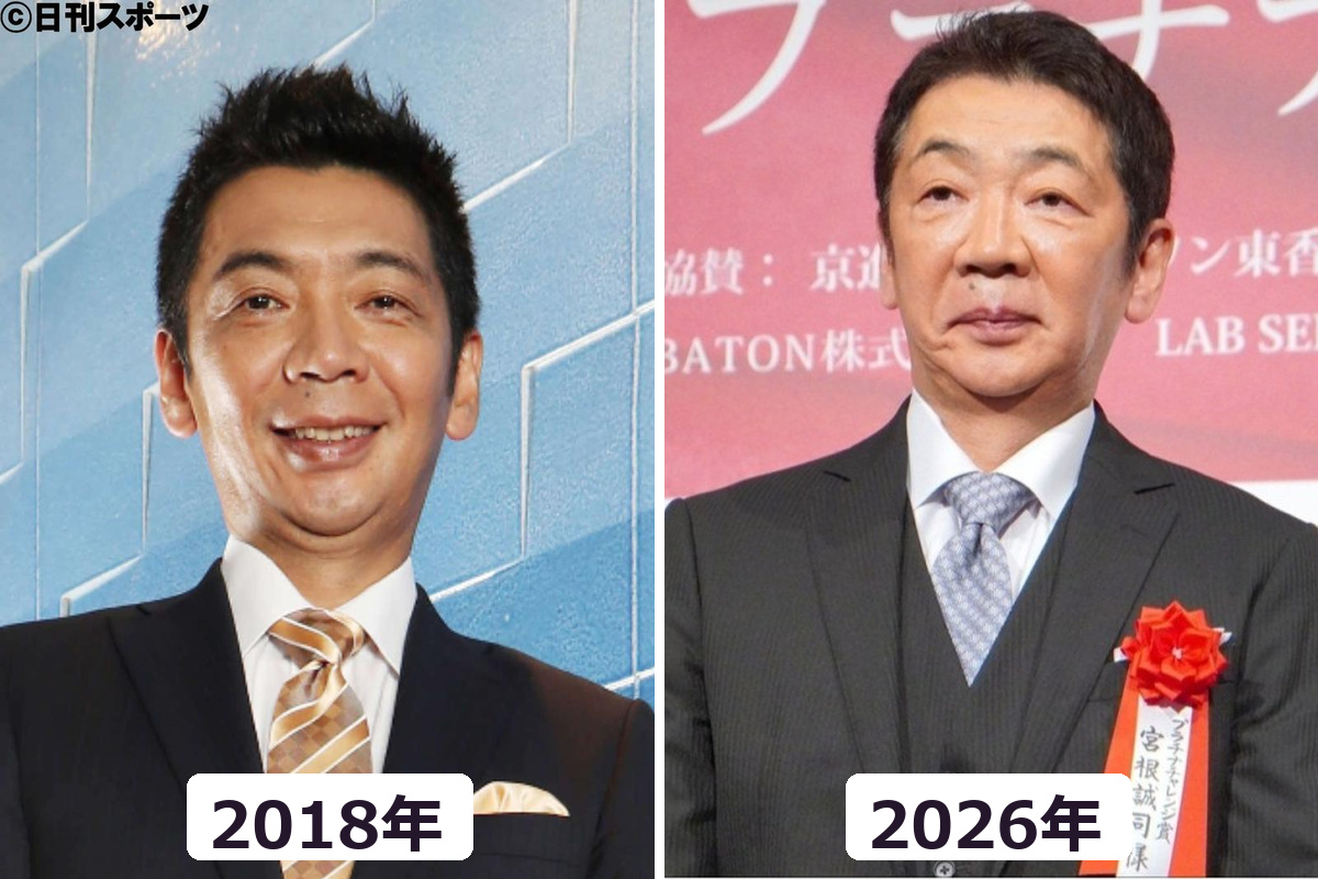 宮根誠司さんのまぶた施術前の2018年と63歳の2026年現在を比較した画像