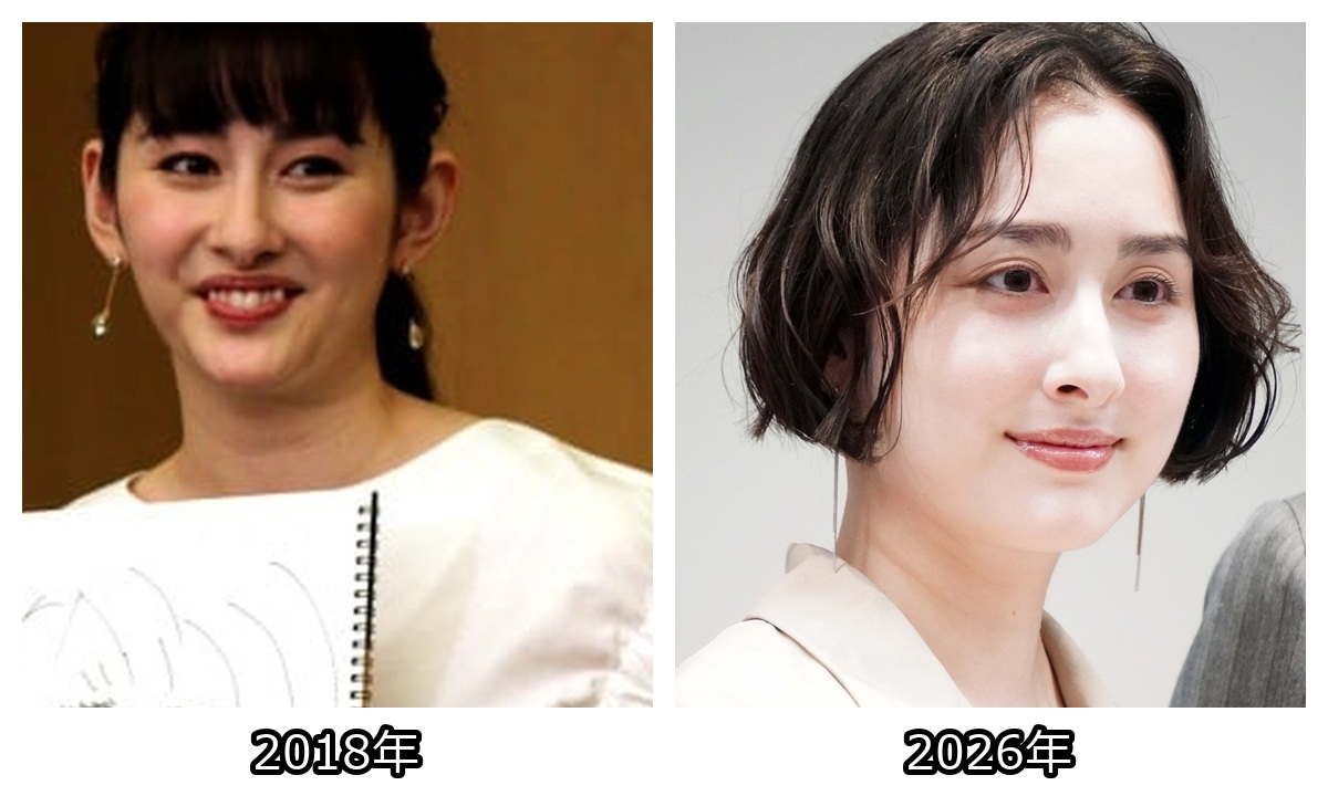 早見あかり 太った|2018年と2026年現在を頭から胸まで比較した画像