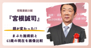 宮根誠司さんの顔が変わったと話題の昔と2026年現在を検証する記事のアイキャッチ