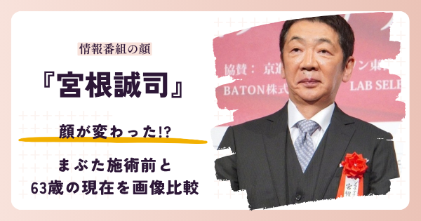 宮根誠司さんの顔が変わったと話題の昔と2026年現在を検証する記事のアイキャッチ