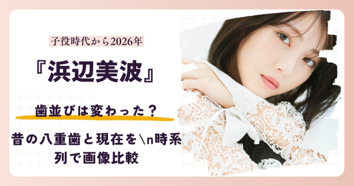 浜辺美波の昔と現在の歯並びを扱う記事のアイキャッチ