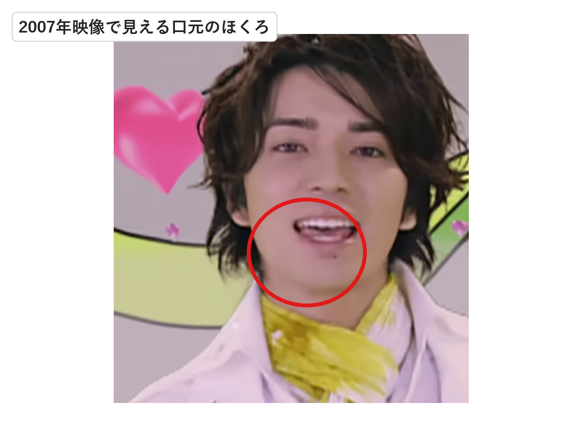 2007年の松本潤の口元に見えるほくろを赤丸で示した画像