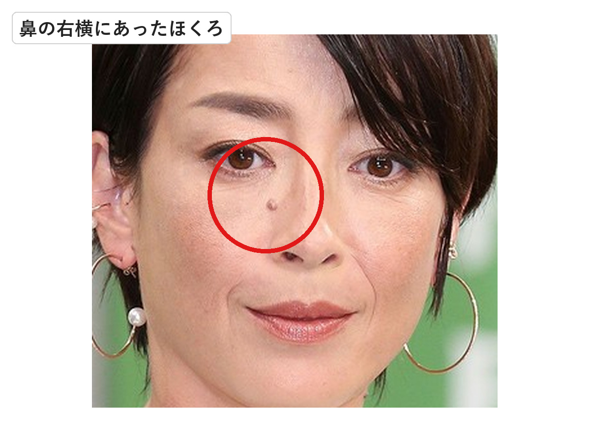 2018年春の宮沢りえの鼻横にあったほくろを赤丸で示した画像