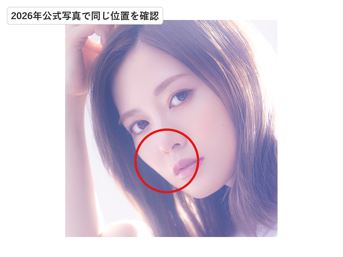 2026年の白石麻衣の口元で以前ほくろがあった位置を赤丸で示した画像
