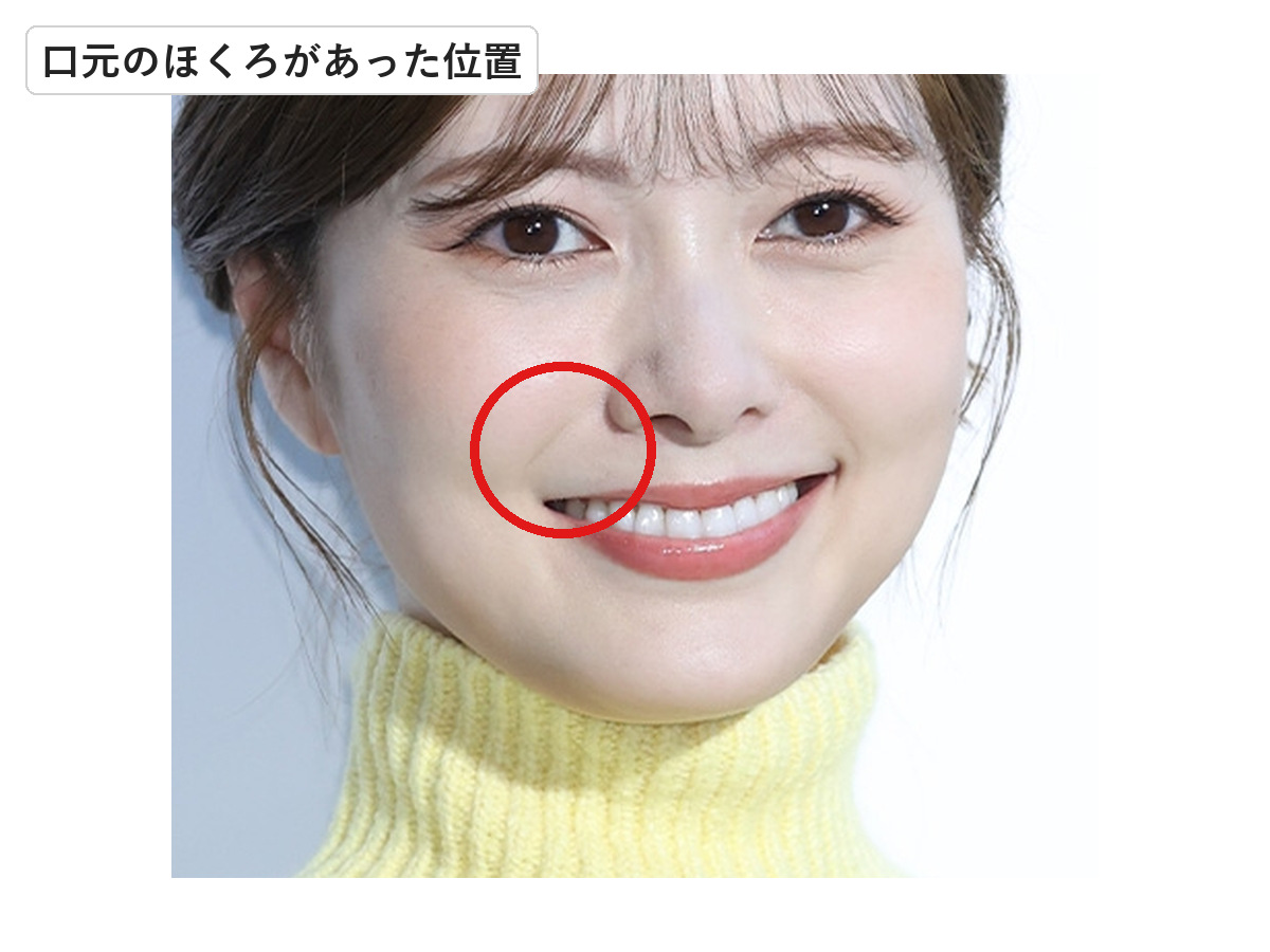 2023年の白石麻衣の口元で以前ほくろがあった位置を赤丸で示した画像