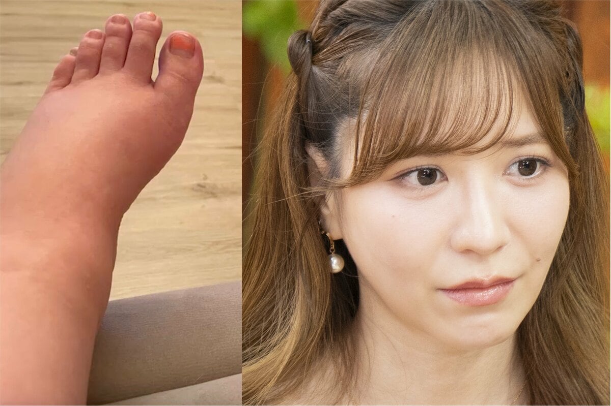 河西智美が公開した産後の足の写真と番組出演時の顔