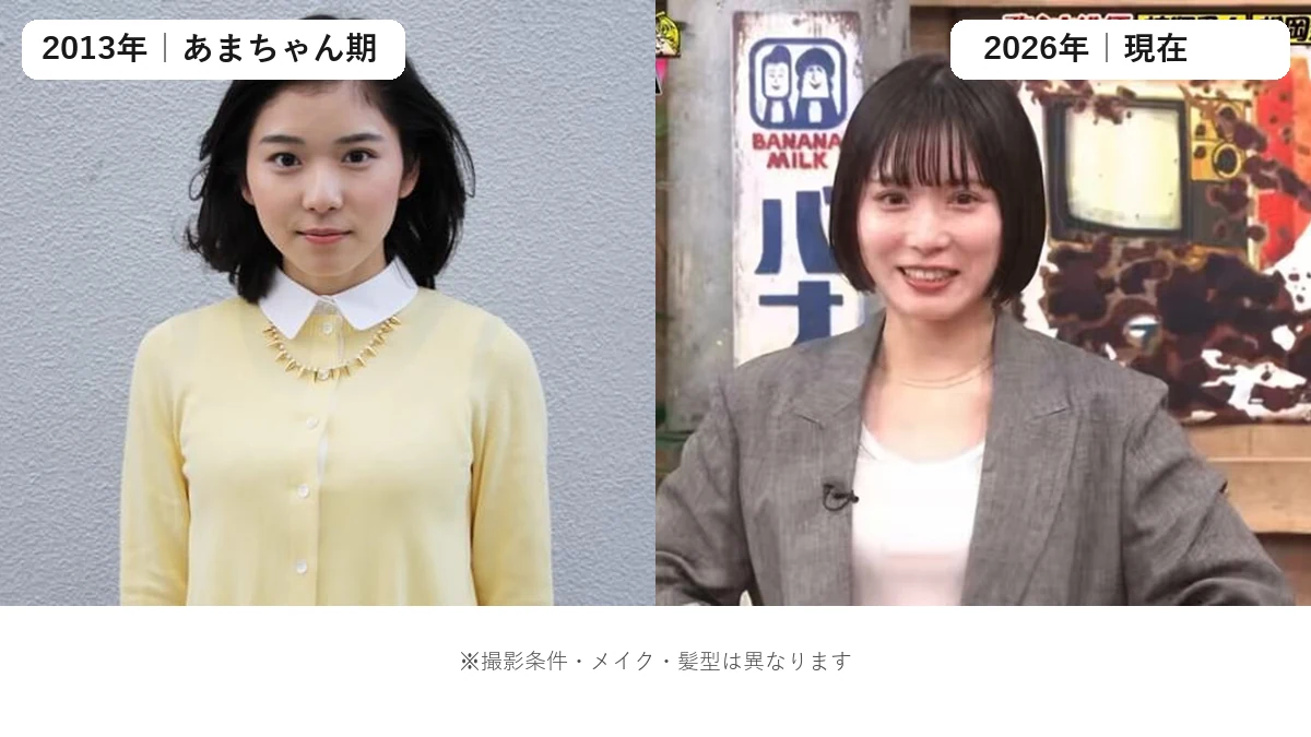 松岡茉優の2013年あまちゃん時代と2026年ダウンタイム主演時を画像比較